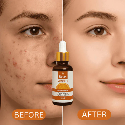 PREMIUM QUALITY RELAX VITAMIN C SERUM  For Smooth Your Skin in Winter ( 59% OFF ) Huge Offer